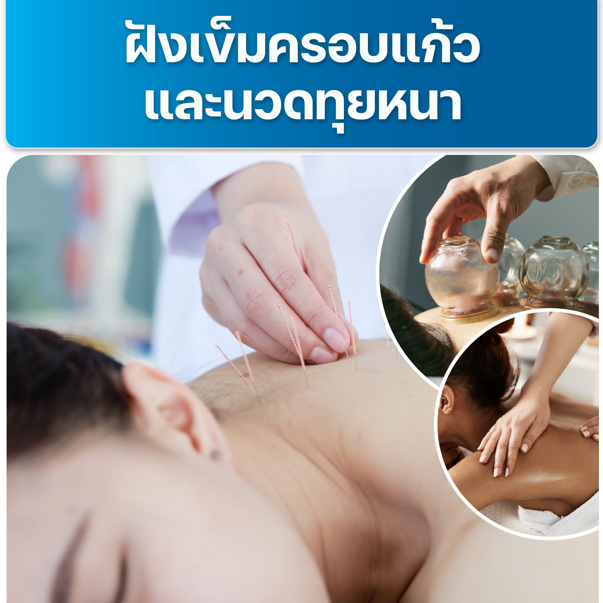 image โปรแกรมฝังเข็มครอบแก้วและนวดทุยหนา