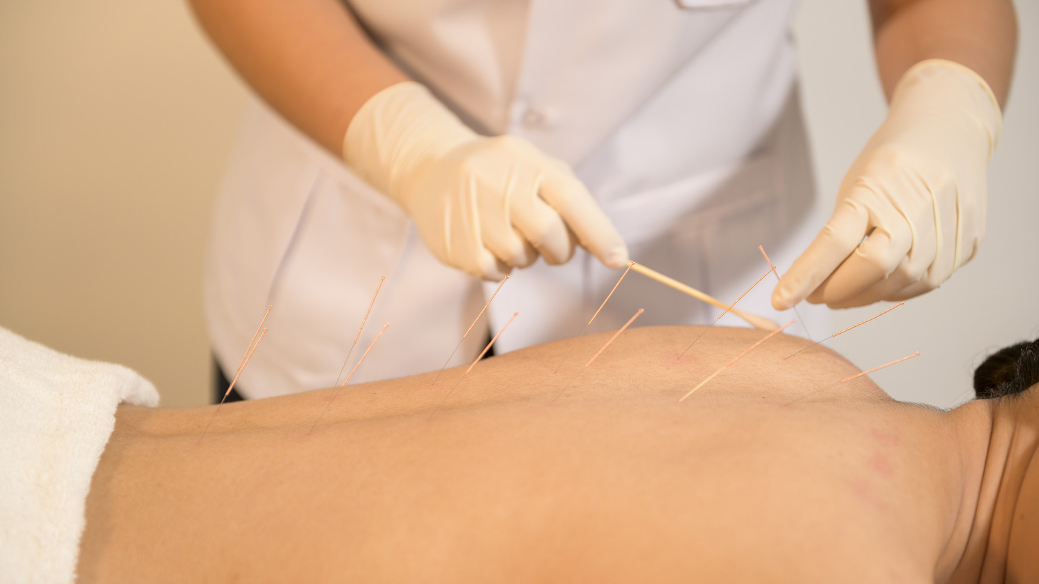 image Traditional Chinese Medicine